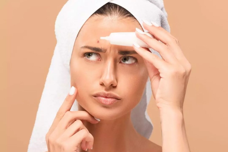 Tips to Fight Acne Breakouts